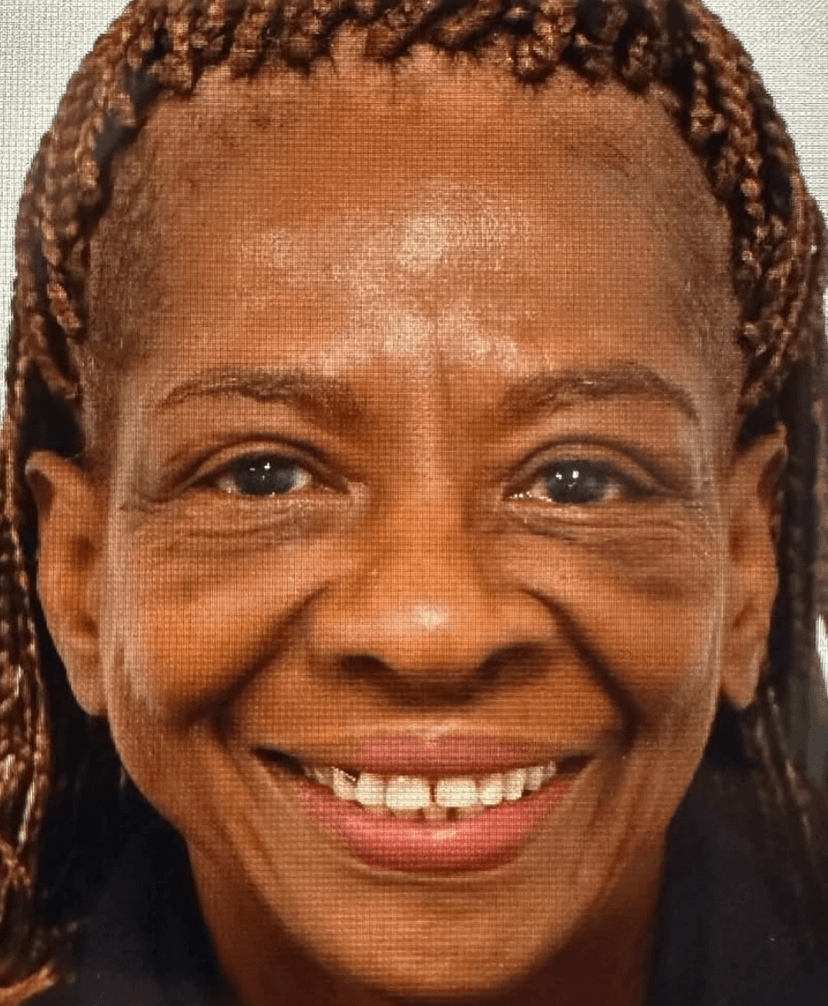 Upper and Lower Blepharoplasty - After