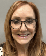 Deep Plane Facelift - After